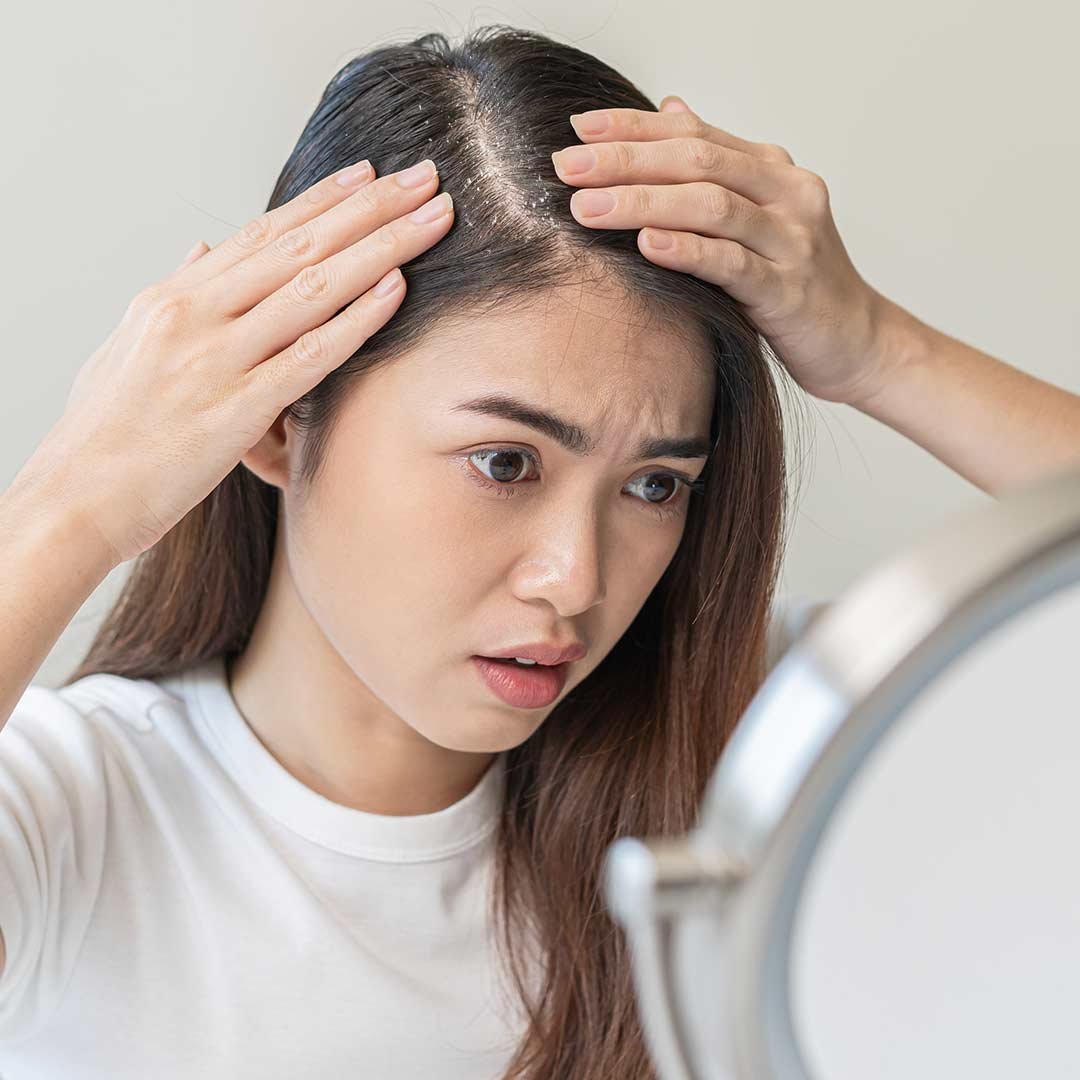 hair-problem